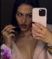 Modeldən qəribə addım - Elə yerinə botoks etdirdi ki... - FOTOlar 