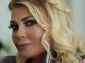 Estetik əməliyyat etdirən Əməkdar artist TANINMAZ HALDA  - VİDEO 