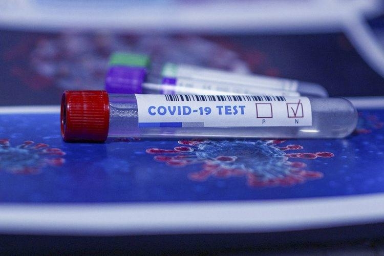 TƏBİB Azərbaycanda koronavirus testlərinin bitməsi barədə məlumatlara aydınlıq gətirib