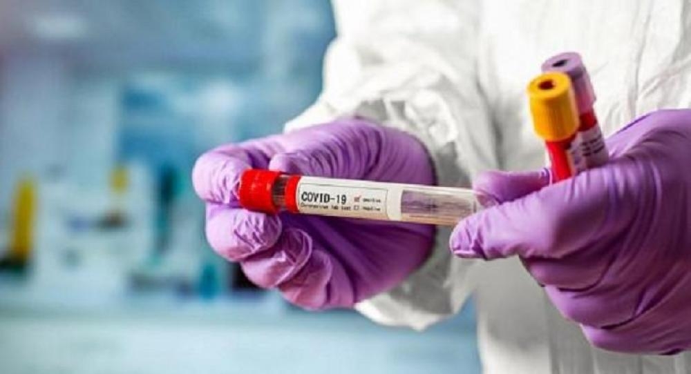 Dost ölkədə koronavirus daha 82 can aldı