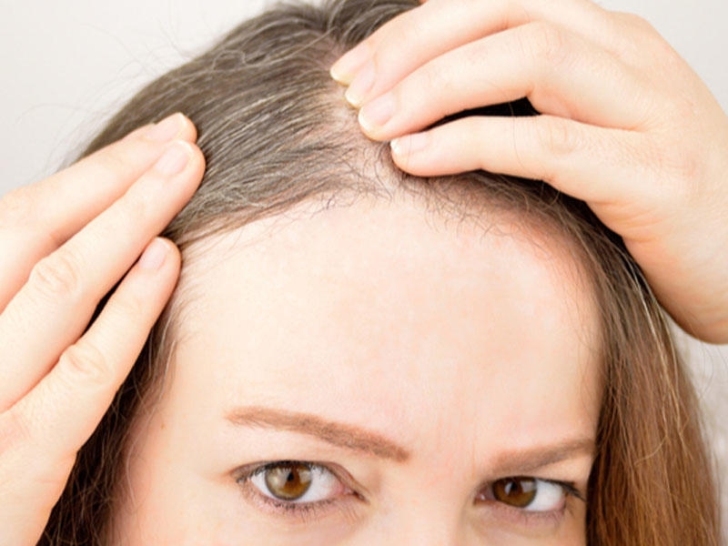 Saçların erkən ağarmasının səbəbləri: Soyuq havada nə etmək lazımdır?