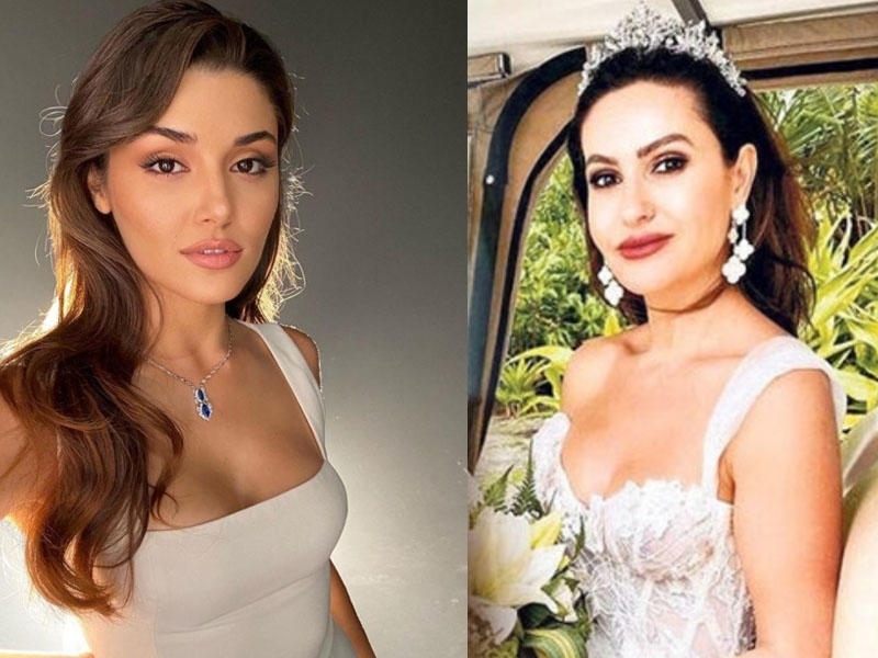 Hande Erçelə bənzəmək istəyən modelyer dişsiz qaldı