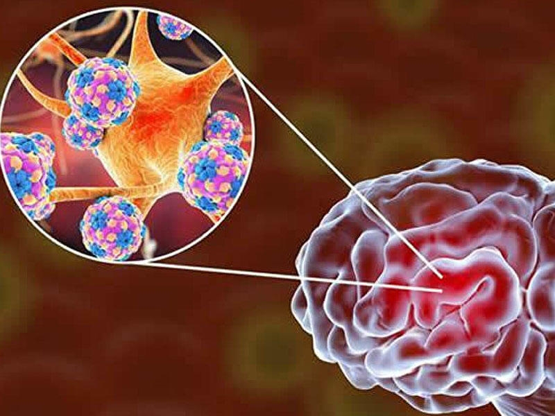 Koronavirus uzun müddət beyin və bağırsaqlarda qalır - Alimlər