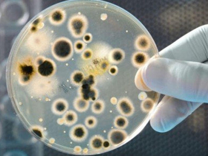 Həkimlər xəbərdarlıq edir! 2050-ci ilə qədər antibiotiklərin təsiri kəskin azalacaq