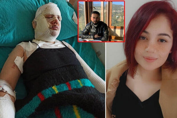 Zəlzələdə evinə sığınan keçmiş arvadının üstünə qaynar su tökən şəxs: Yeraltı təkanlar səbəb oldu - FOTO