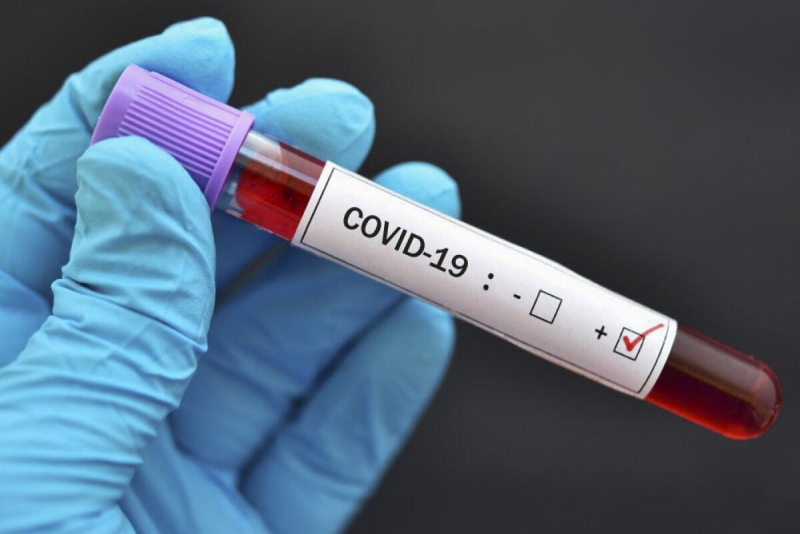 ÜST: Son 28 gündə dünyada COVID-19-a yoluxma  63 % artıb