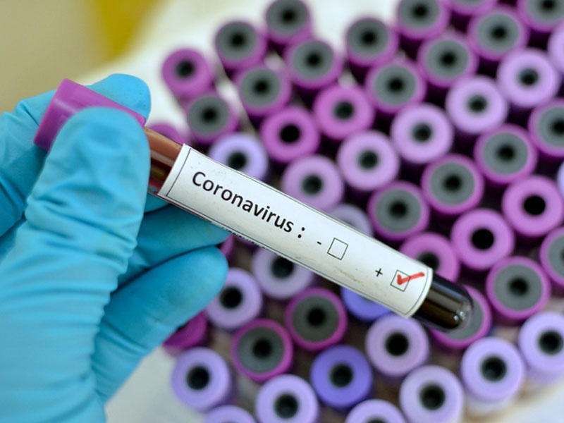 Koronavirus vaksinini hazırlayana 200 000 ABŞ dolları veriləcək