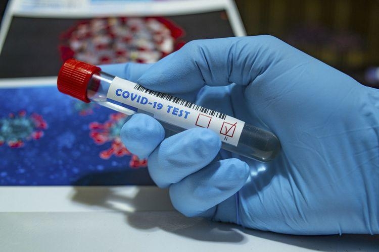 Daha 438 nəfərdə koronavirus aşkarlandı, 4 nəfər vəfat etdi, 133 nəfər sağaldı