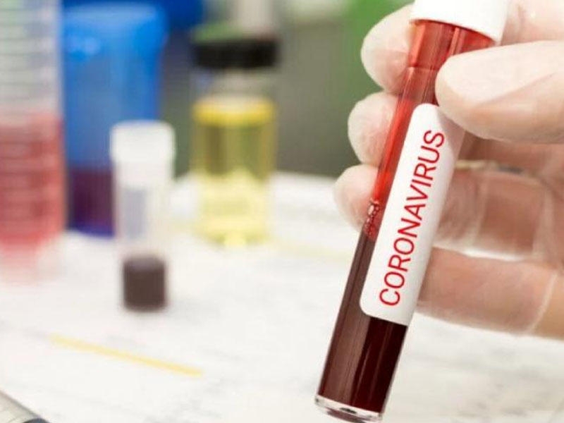 Azərbaycanda aparılmış koronavirus testlərinin sayı 600 mini keçib