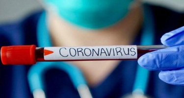 Alim açıqladı - İmmunitet koronavirus üzərində nə qədər təsirli olur?
