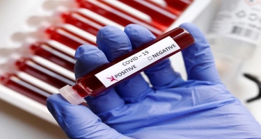 Azərbaycanda ümumilikdə 790 141 koronavirus testi aparılıb