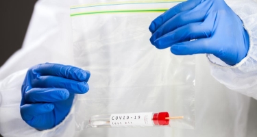 Ən sürətli koronavirus testi hazırlanıb