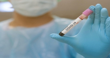 Gürcüstanda son sutkada koronavirusa 1800 yoluxma qeydə alınıb, 20 nəfər ölüb