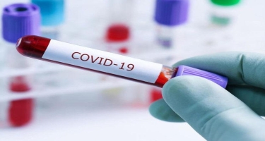 ABŞ-da son sutkada COVID-19-a 130 485 yoluxma qeydə alınıb, 1769 nəfər ölüb