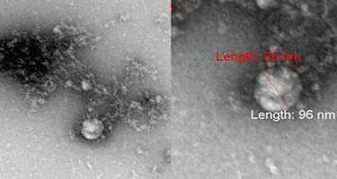 Mutasiyaya uğramış koronavirusun mikroskop altında görüntüsü