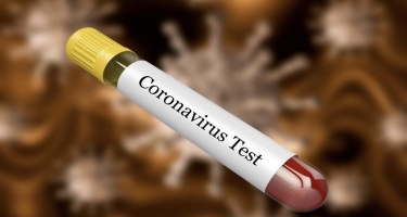 Azərbaycanda indiyədək 2 543 880 koronavirus testi aparılıb
