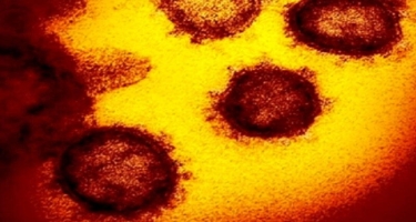 Yaponiyaya Filippindən gəlmiş şəxsdə koronavirusun yeni ştammı aşkar edilib
