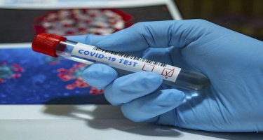 Azərbaycanda indiyədək 2 790 980 koronavirus testi aparılıb