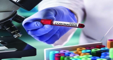 Koronavirusu 5 dəqiqəyə aşkar edə bilən TEST HAZIRLANDI