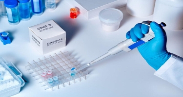 İran koronavirusun dörd mutasiyasını aşkar edən test yaratdı