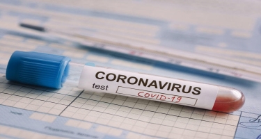 Rusiyanın 54 regionunda koronavirusun yeni ştammı aşkarlanıb