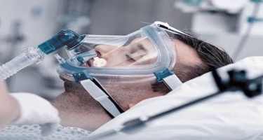 Türkiyədə COVID-19-un müalicəsində böyük əhəmiyyət kəsb edəcək oksigen terapiyası cihazı hazırlanıb