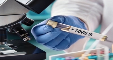 Proqnoz: yayın sonunda Avropada koronavirusun 