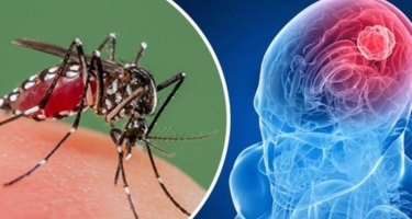 Hindistanda indi də “Zika” kabusu yaşanır – Peyvəndi və müalicəsi yoxdur