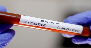 Şotlandiyada koronavirusla bağlı məhdudiyyətlər aradan qaldırıldı