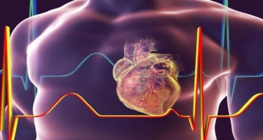 Həkim-kardioloq: Təngnəfəslik ürək-damar xəstəliklərinin başlıca simptomlarındandır