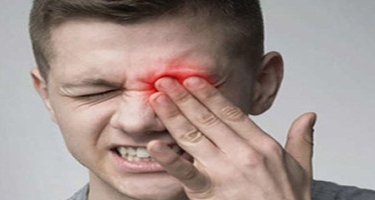 Həkim-oftalmoloq: Sinirlərlə zəngin olan göz ağrılarına beyin mənşəli xəstəliklər də səbəb ola bilər