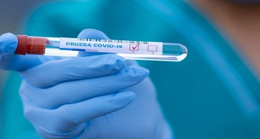 Gürcüstanda son sutkada koronavirusa 4 278 yoluxma halı qeydə alınıb, 63 nəfər ölüb