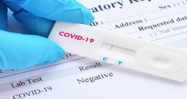 Rusiyada koronavirus testinin müddətini 48 saatadək azaltdı