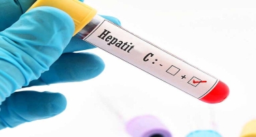 Hepatit C 3 aya tam müalicə olunur