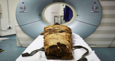 Mumiyanı rentgen aparatına saldılar: Heyrətə gəldilər - 140 il sonra... - FOTO