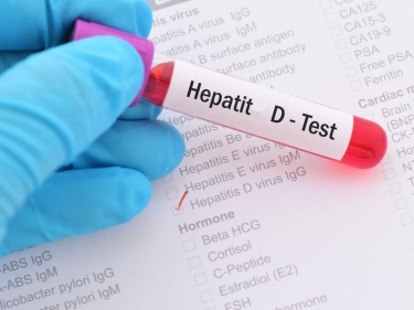 Hepatit D nədir? - Əlamətləri