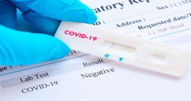 “PCR testi mənfi çıxanlar da koronaviruslu ola bilər” - İnfeksionist
