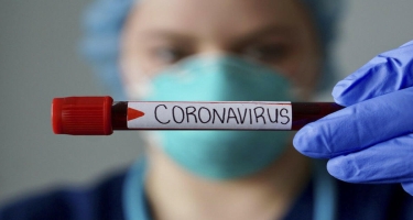 Ermənistanda koronavirusdan ölənlərin sayı 8 607 nəfərə yüksəlib