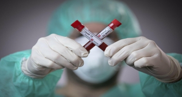 Rusiyada daha 398 nəfər koronavirusdan ölüb