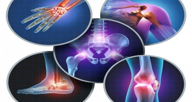 Böyük-kiçik oynaqlarda ağrı və yeyilmə səbəbi - Osteoartrit nədir?