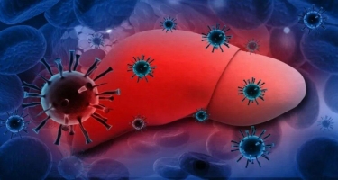Qorxulu hepatit 33 ölkədə: 9 uşaq öldü,  75%-dən çoxu..