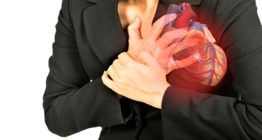 Miokard infarktı zamanı lazım olan müalicə metodları