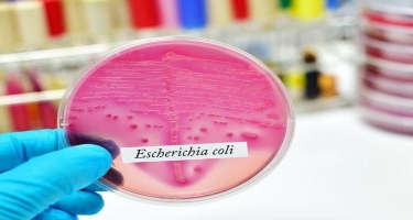 Bu qidalarda “E.coli” bakteriyası tapıldı - İnsanı öldürür