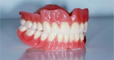Diş protezlərinin allergik təsirləri