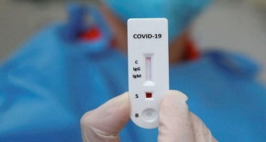 “Koronavirus ştamları təxminən hər səkkiz aydan bir dəyişir” - Rusiyalı mikrobioloq alim