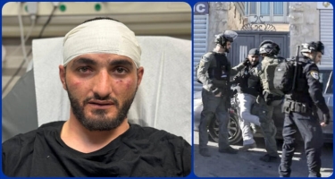 İsrail polisi türk fotomüxbiri döydü