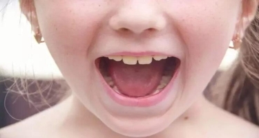Süd dişləri niyə belə adlanır?