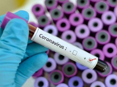 Koronavirus pandemiyası: PANDEMİYA NƏDİR?