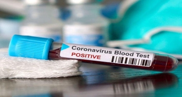 Koronavirusa asanlıqla yoluxa biləcəyiniz 5 YER