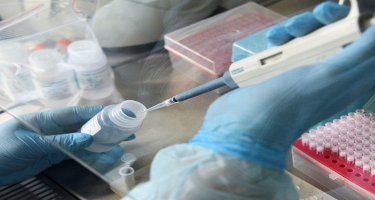 “Koronavirus testləri məhdud saydadır” - Amazon laboratoriya yaradır